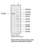 Protein Enzyme Kinase IĸB kinase β (IKKβ)