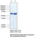 Pure protein isolated from human plasma Protein Alpha-1 Antitrypsin (AAT)