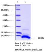 Chemokine (C-X-C motif) ligand 12 (CXCL12) is a homeostatic chemokine and member of the CXC chemokine subfamily