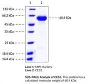 Carboxylesterase 2 (CES2) is a serine hydrolase with a major role in endo- and xenobiotic metabolism