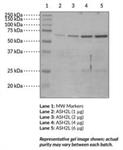 ASH2L is the human homolog of the Drosophila absent, small or homeotic discs 2 (ash2) gene product, a member of the trithorax group (TrxG) of proteins.